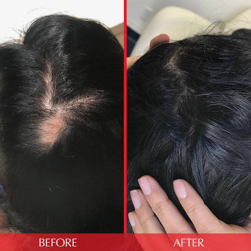 HAIRtamin HAIRtamin Advanced Formula 1 Month 50% Rabatt mit kostenlosem Versand