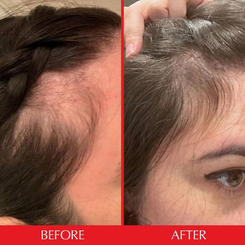 HAIRtamin Gummy Stars™ 1 Month Flash Sale