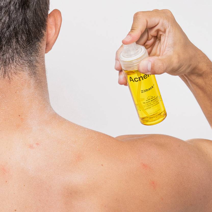 Acnemy Zitback® (80ml) Bis zu 60% Rabatt