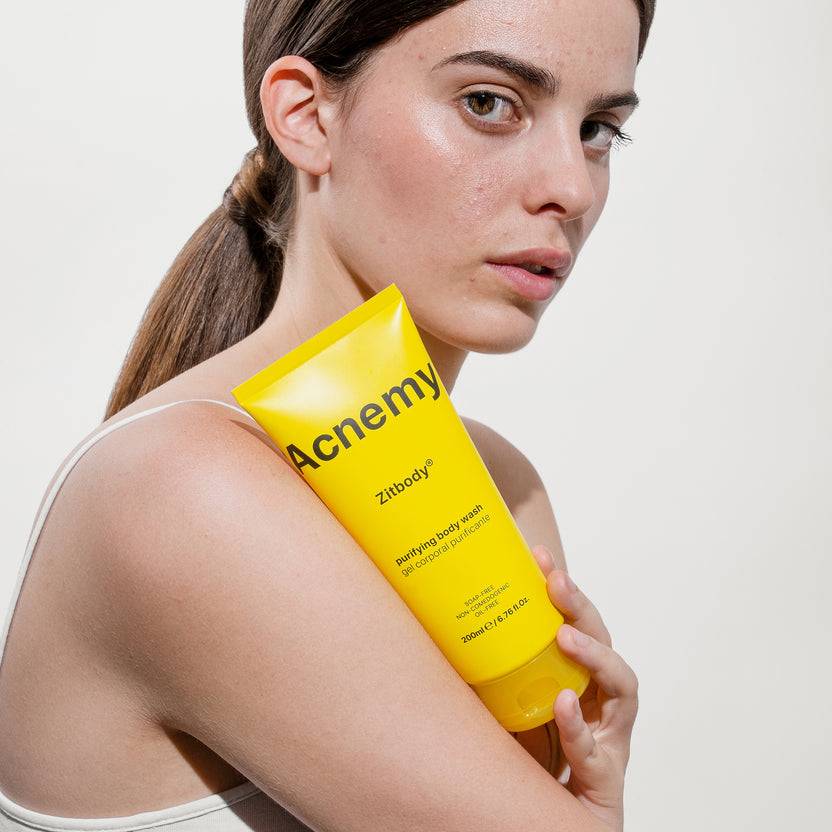 Acnemy Zitbody (200ml) Vierteljährliche Förderung