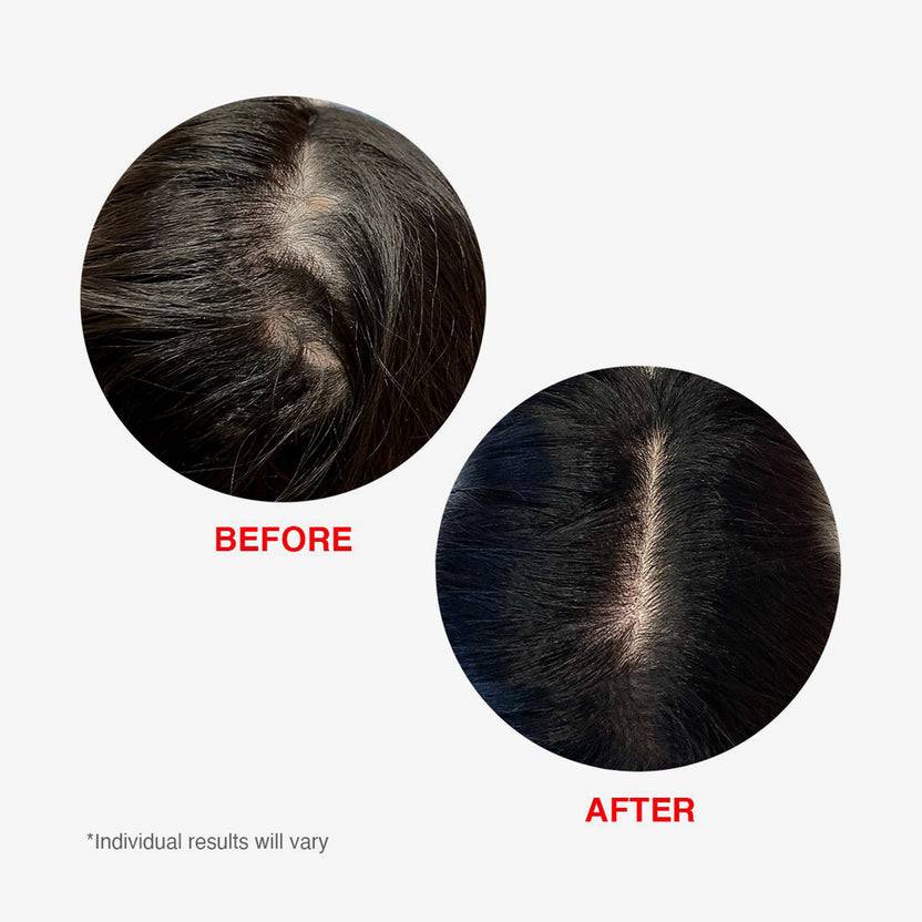 HAIRtamin Scalp Serum (60ml) Im Verkauf