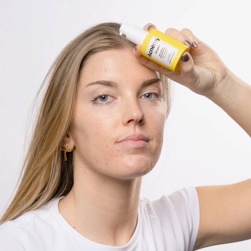 Acnemy Zitcalm Serum (30ml) Sonderangebote