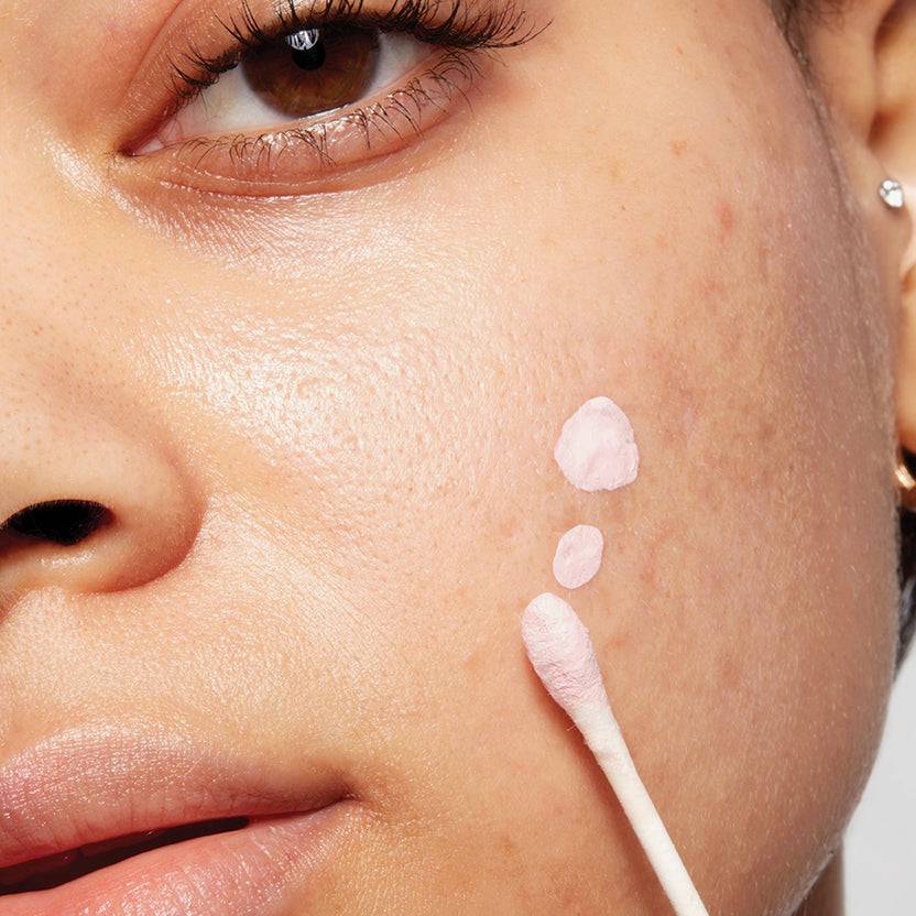 Mario Badescu Acne Control Super Sparpreis