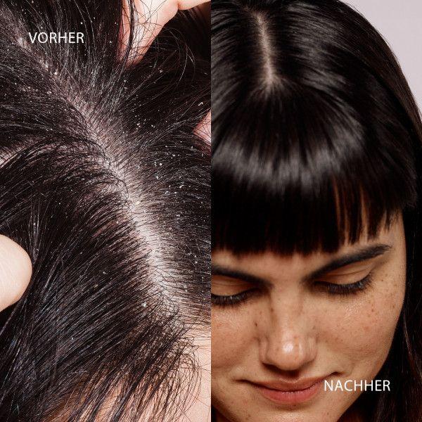 bodyguardapotheke DUCRAY KELUAL DS Anti-Schuppen-Shampoo Kostenlose Rückgabe