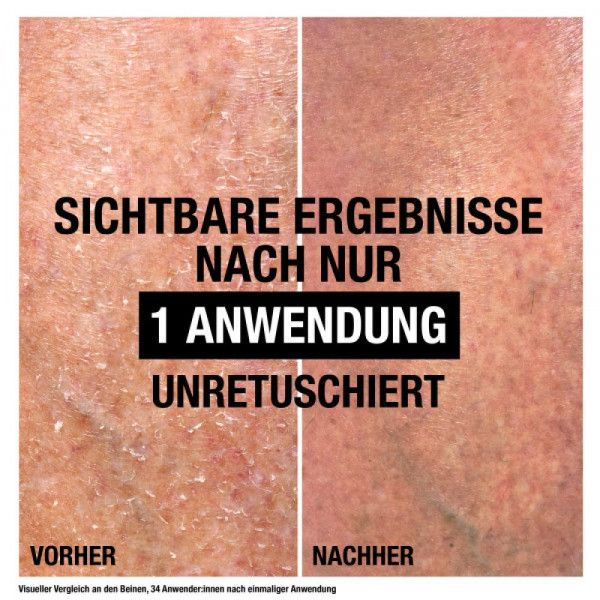 bodyguardapotheke NEUTROGENA Intense Repair CICA Bodybalsam Outlet