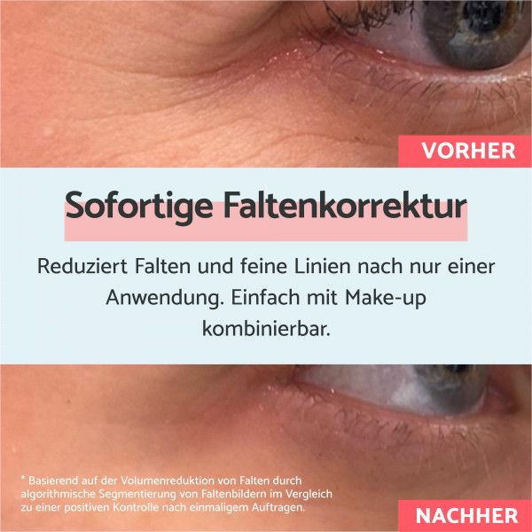 bodyguardapotheke Remescar Anti-Falten-Creme mit Soforteffekt 8ml Kauf eins, bekomm eins gratis