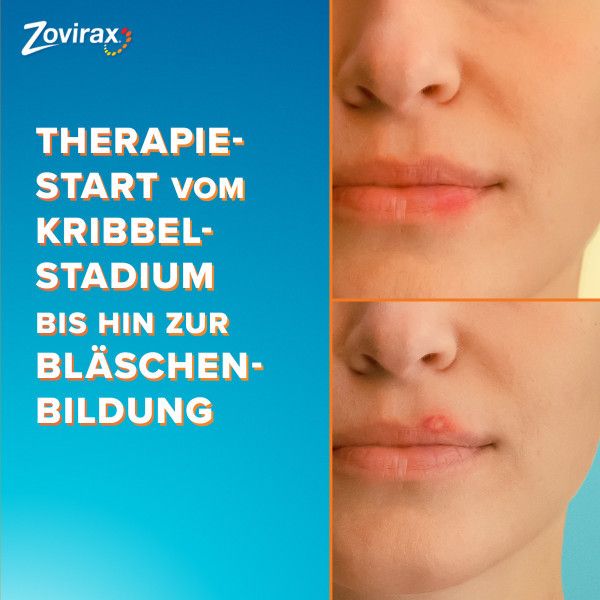 bodyguardapotheke ZOVIRAX Lippenherpes Creme Auslauf