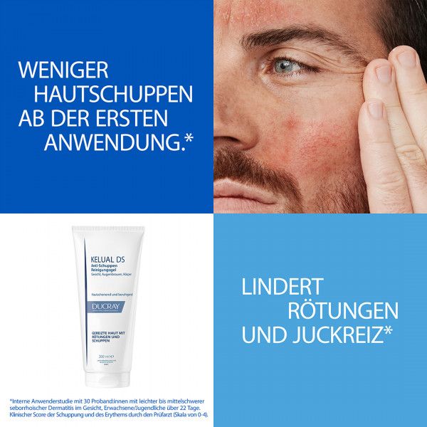bodyguardapotheke DUCRAY KELUAL DS Anti-Schuppen Reinigungsgel Flash Sale
