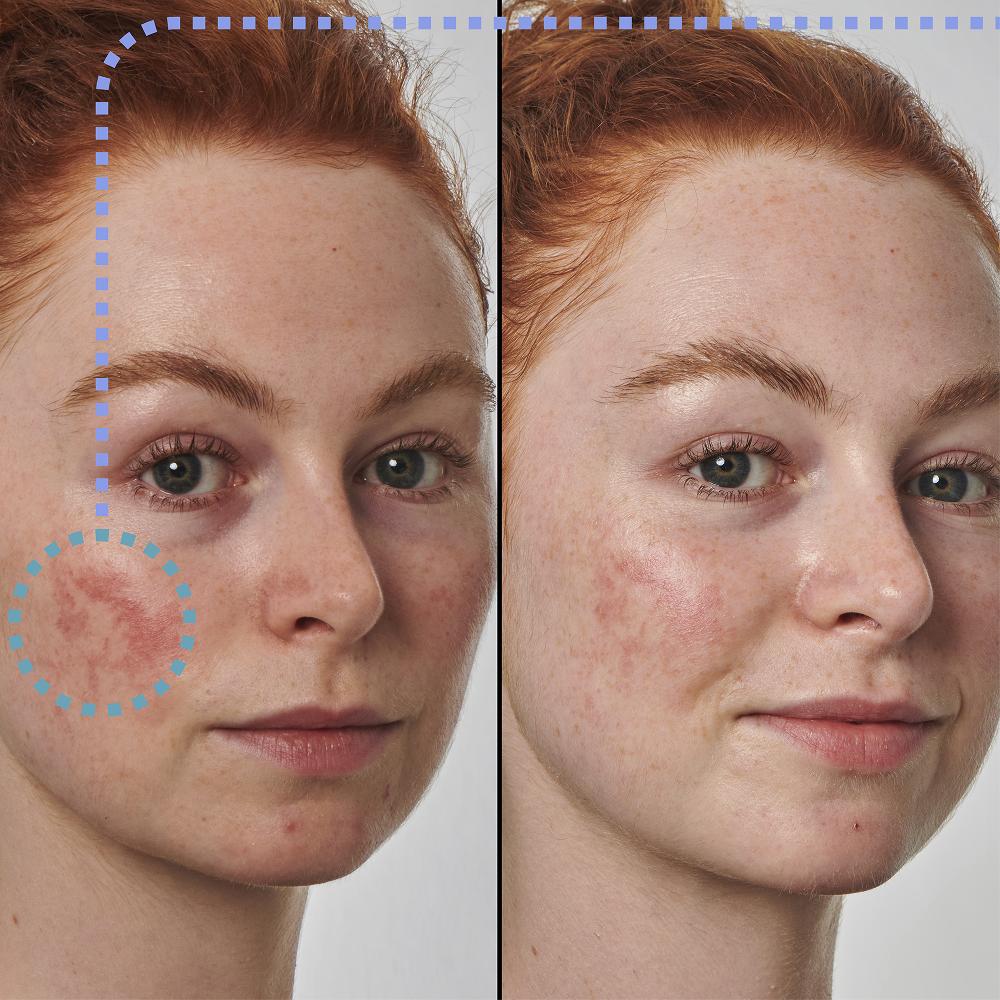 lookfantastic The INKEY List Super Solutions 10 % Azelainsäure-Serum 30 ml Bis zu 60% Rabatt