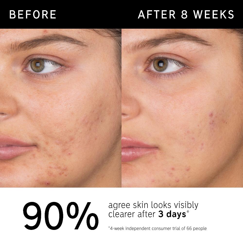 lookfantastic The INKEY List Salizylsäure-Gesichtsreinigung 150 ml Nur für heute