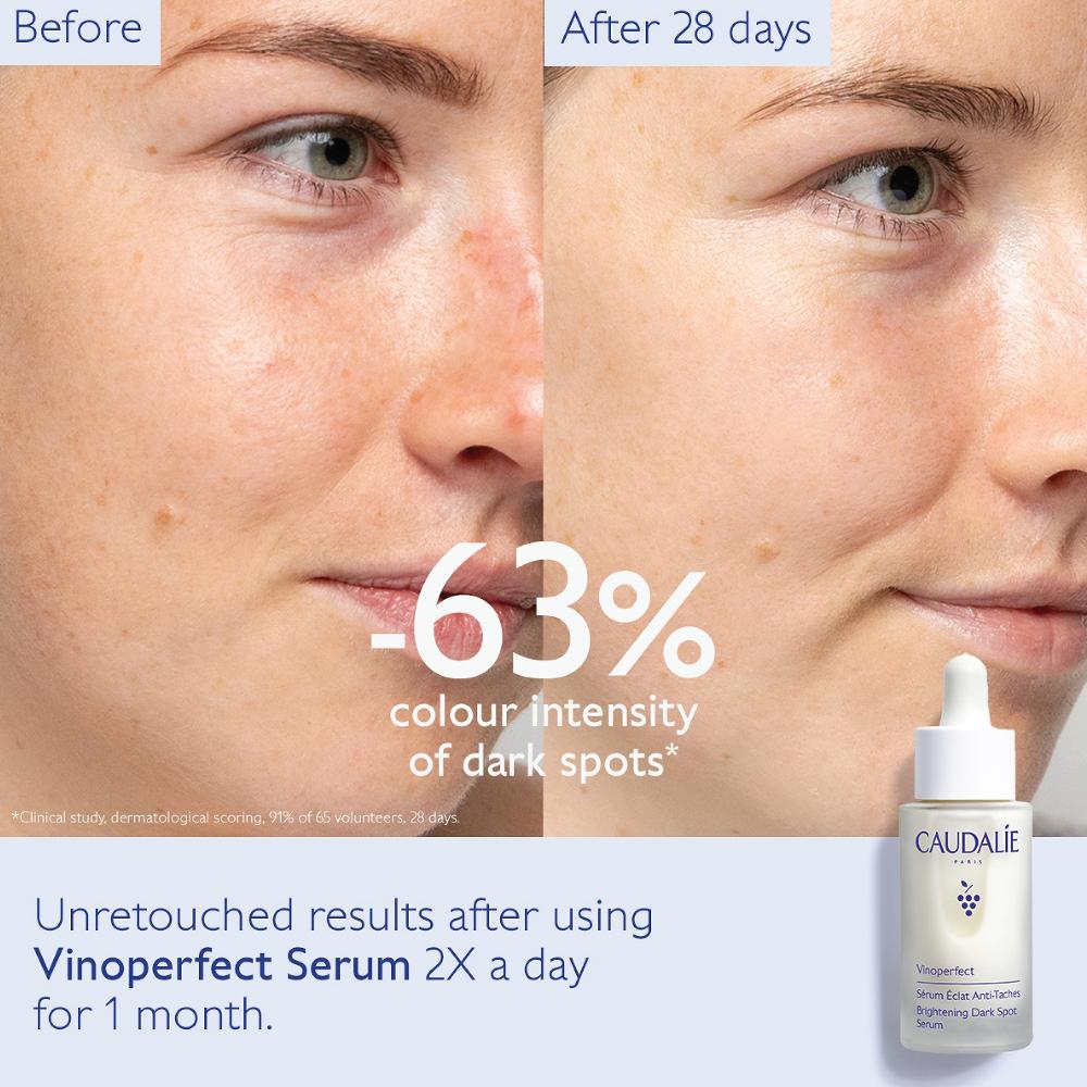 lookfantastic Caudalie Vinoperfect Aufhellendes Serum Gegen Dunkle Flecken 30 ml 50% Rabatt mit kostenlosem Versand
