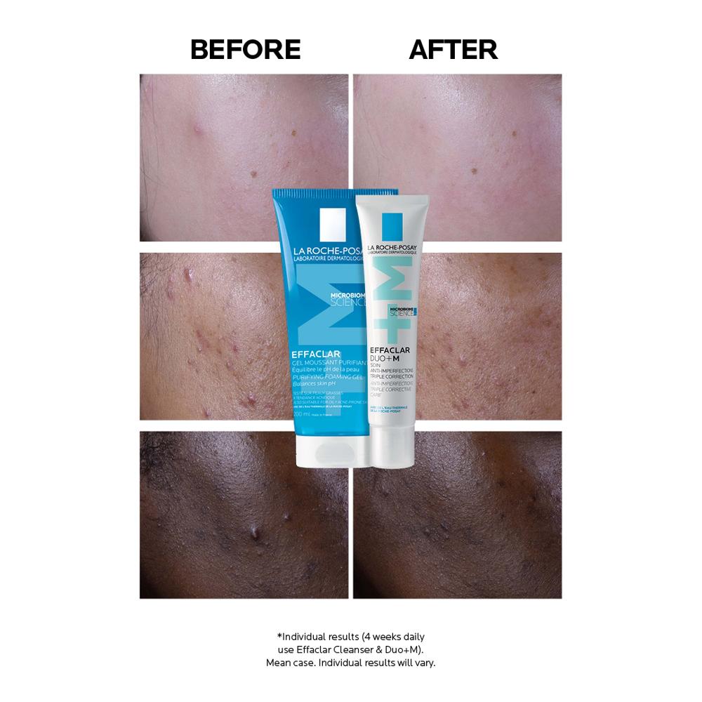lookfantastic La Roche-Posay Effaclar Duo+M Unreinheitenkorrigierende Gel-Feuchtigkeitspflege für Fettige zu Unreinheiten Neigende Haut 40 ml Letzte 2 Tage