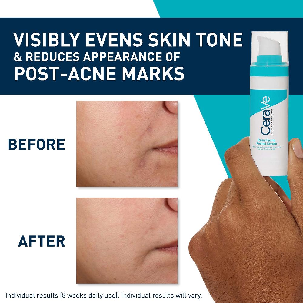 lookfantastic CeraVe Resurfacing Retinol Serum with Ceramides and Niacinamide for Blemish-Prone Skin 30ml Großer Ausverkauf